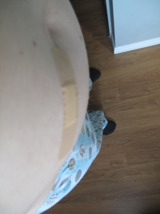 Here is my amno bandaid, earned on August 22 2013. Yep, it hurt. 